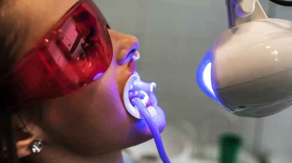 Frau mit Schutzbrille bei professioneller Zahnaufhellung (Bleaching) in der Zahnarztpraxis – Anwendung mit Speziallampe.