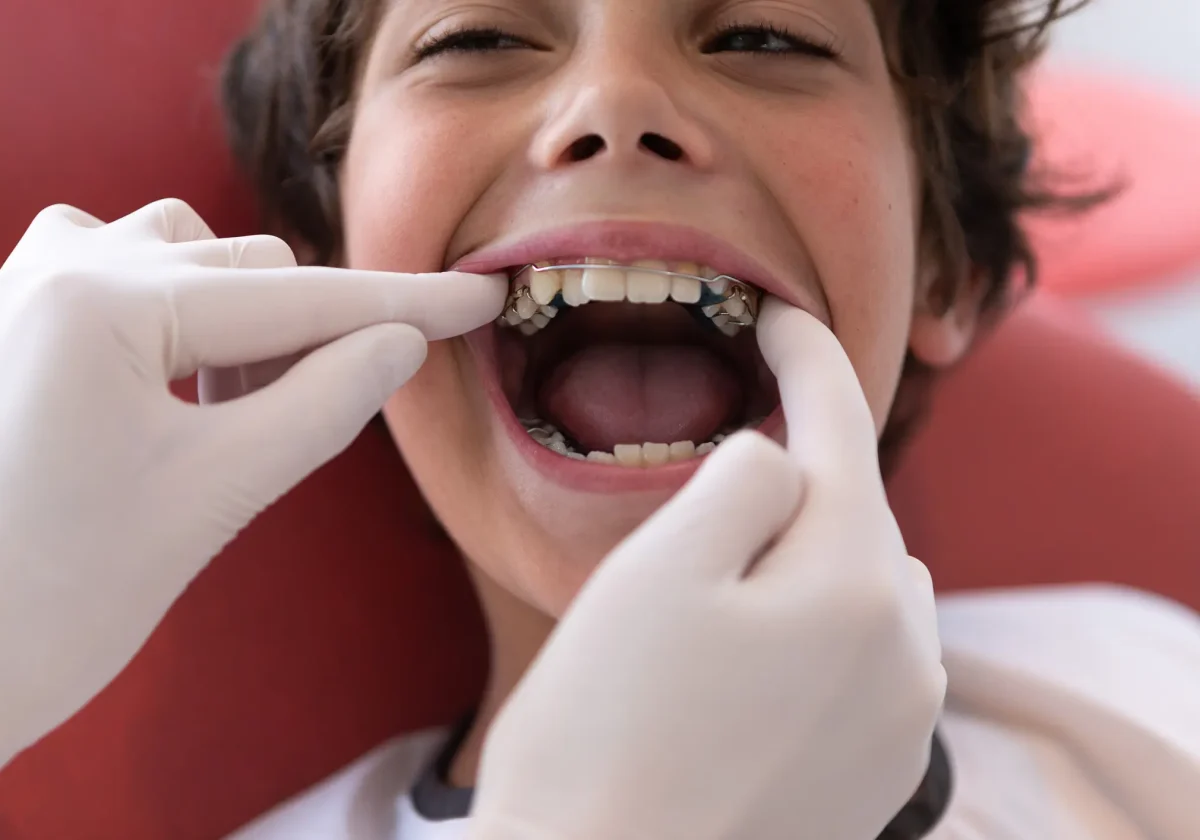 Kind mit Zahnspange bei der Kontrolle – veranschaulicht kieferorthopädische Behandlung und Einstufung in eine KIG-Stufe.